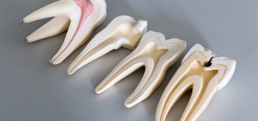 Les différentes parties de la dent sont visibles